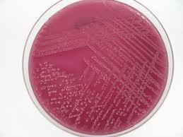 MacConkey Agar (With Salt)