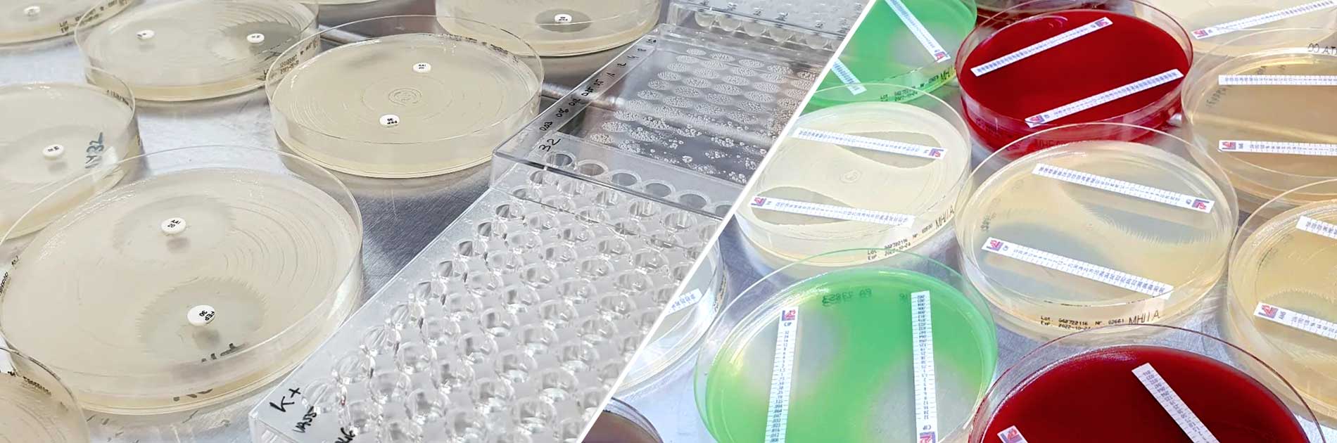 Antibimikrobiyal duyarlılık testleri