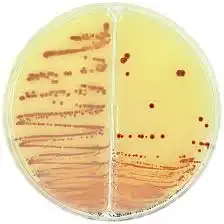 İki bölmeli petride besiyerleri